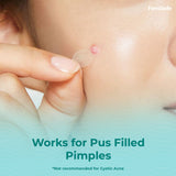 ACNE PIMPLE PATCH
